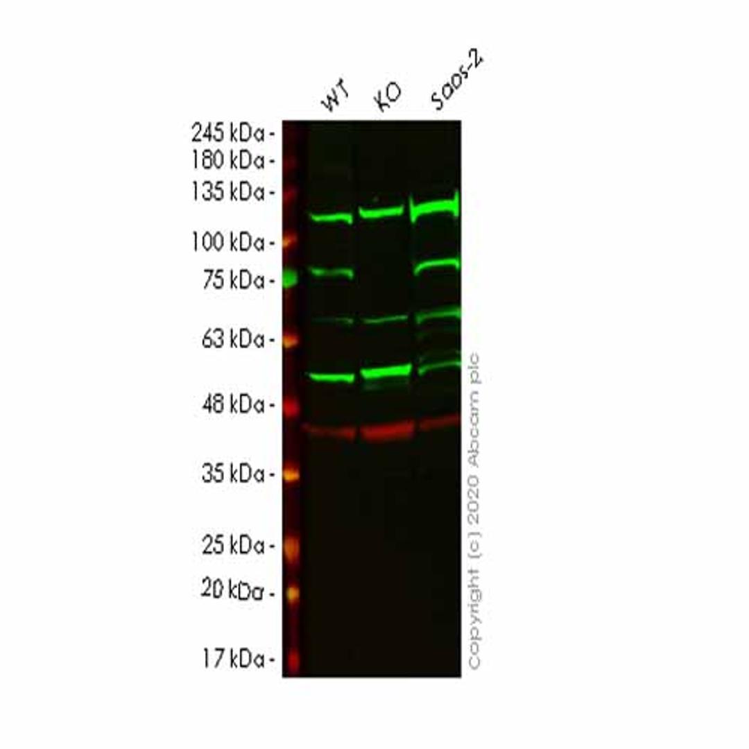 Human FERMT2 (Kindlin 2) knockout HeLa cell line - Abcam plc - Life Sciences
