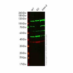 Human FERMT2 (Kindlin 2) knockout HeLa cell line - Abcam plc - Life Sciences
