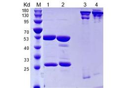 Anti-Human IL5 Recombinant Antibody (TAB-031)