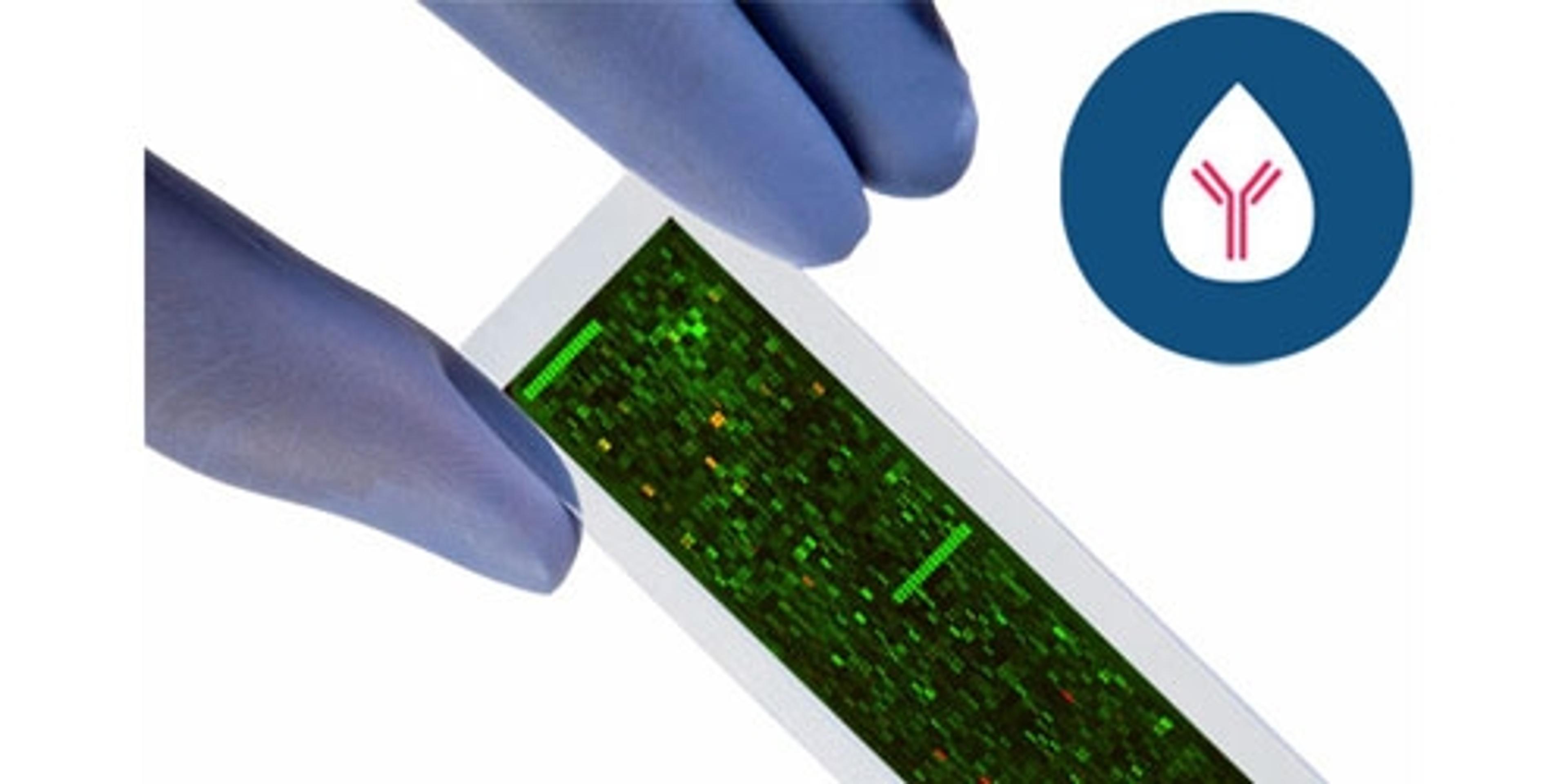 PEPperCHIP® Autoimmune Epitope Microarray - PEPperPRINT GmbH - Life Sciences