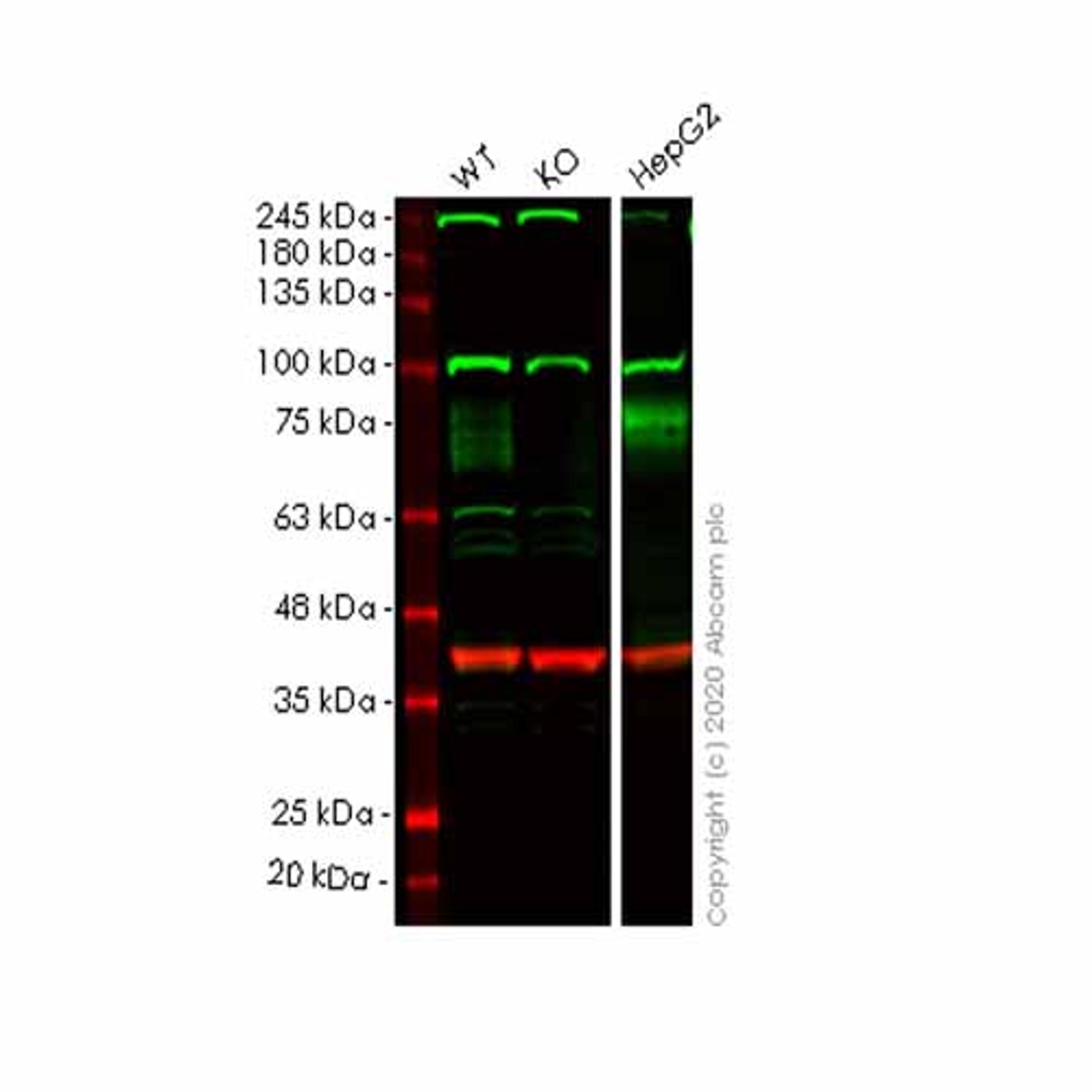 Human IFNGR1 knockout HeLa cell line - Abcam plc - Life Sciences