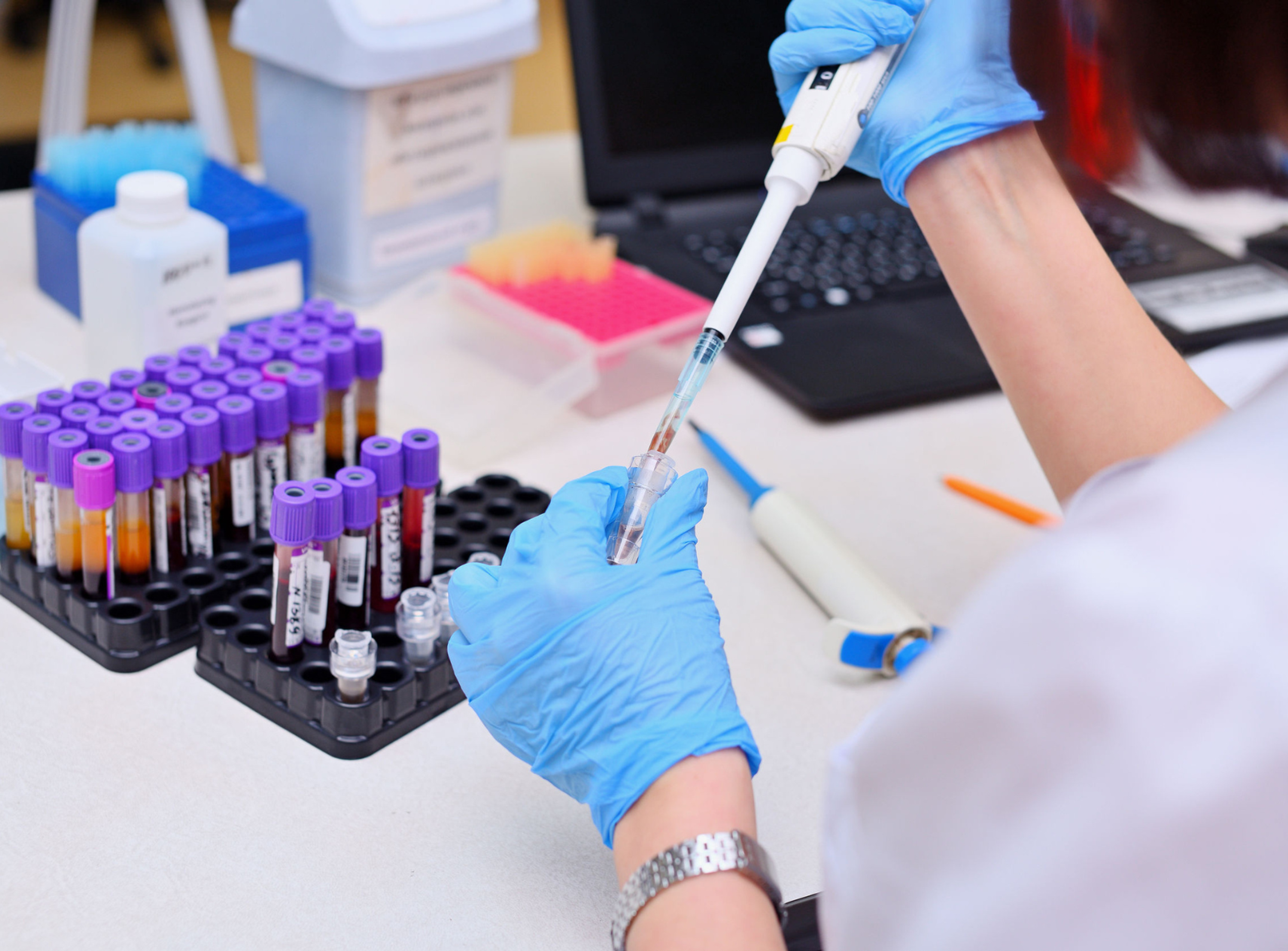 blood tests being carried out at the bench by a medical laboratory scientist