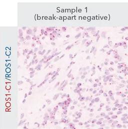 DNAscope Duplex Assay - Advanced Cell Diagnostics - Life Sciences
