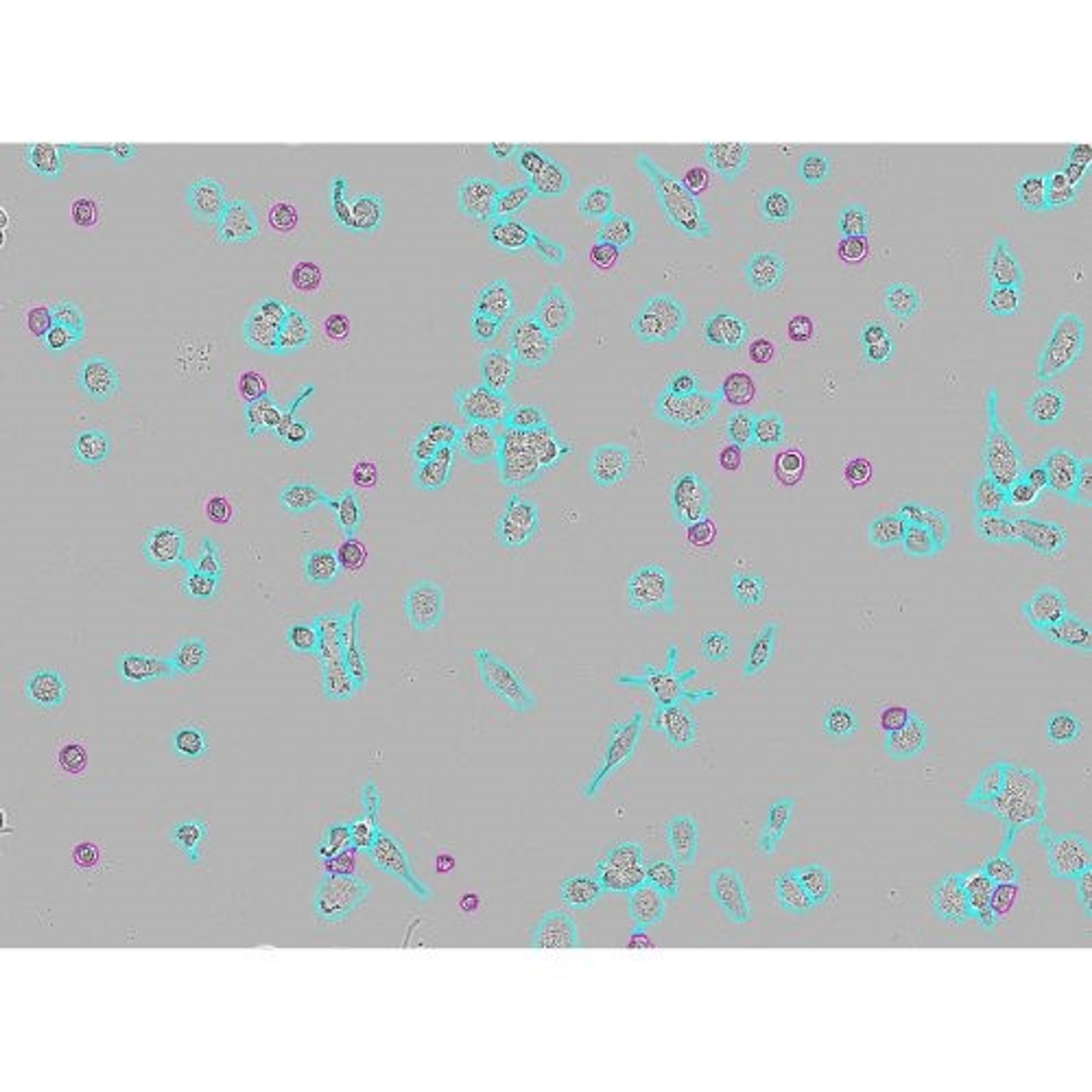 Incucyte® Advanced Label-Free Classification Analysis Software Module - Sartorius Group - Life Sciences