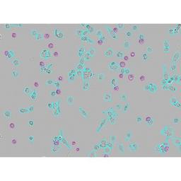 Incucyte® Advanced Label-Free Classification Analysis Software Module - Sartorius Group - Life Sciences