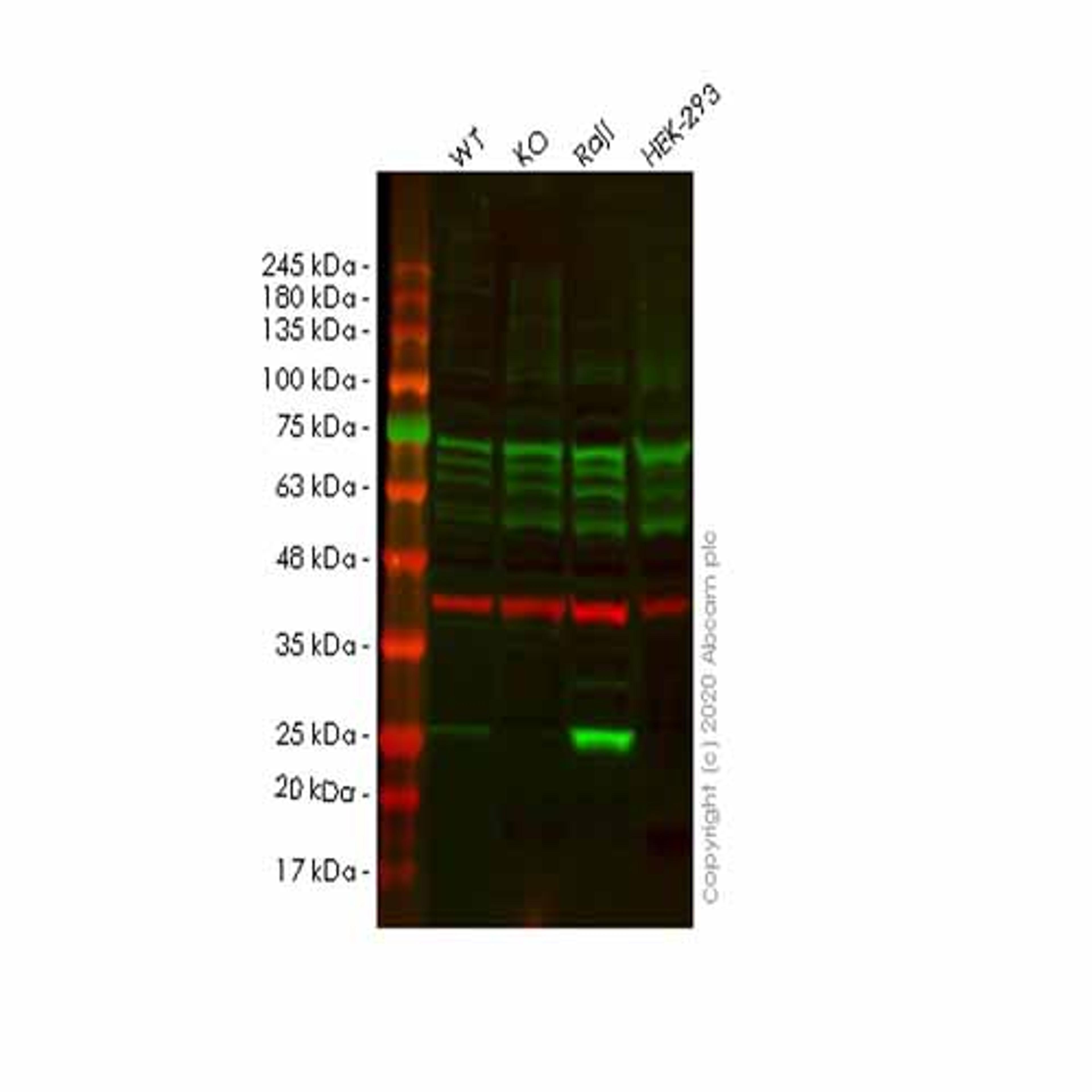 Human PSMB8 (Proteasome 20S LMP7) knockout A549 cell line - Abcam plc - Life Sciences