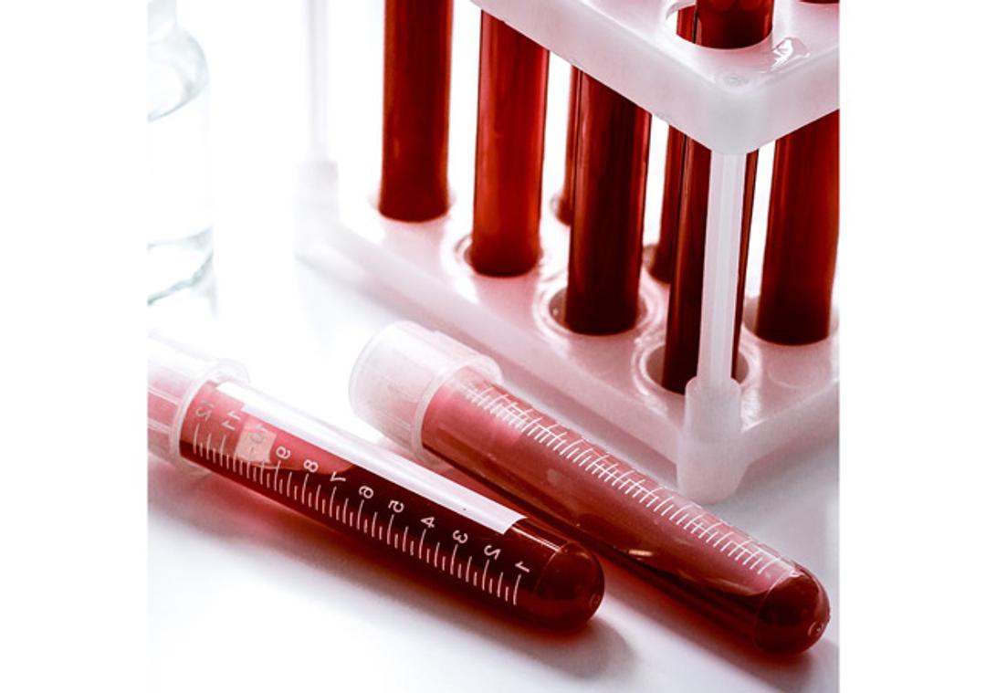 Blood, Plasma and Serum - BioIVT - Life Sciences