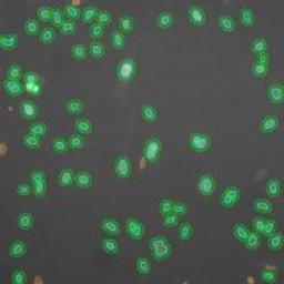 Molecular Translocation V2 Image Analysis BioApplication for Kinase and transcription factor activation - null - Lab Informatics