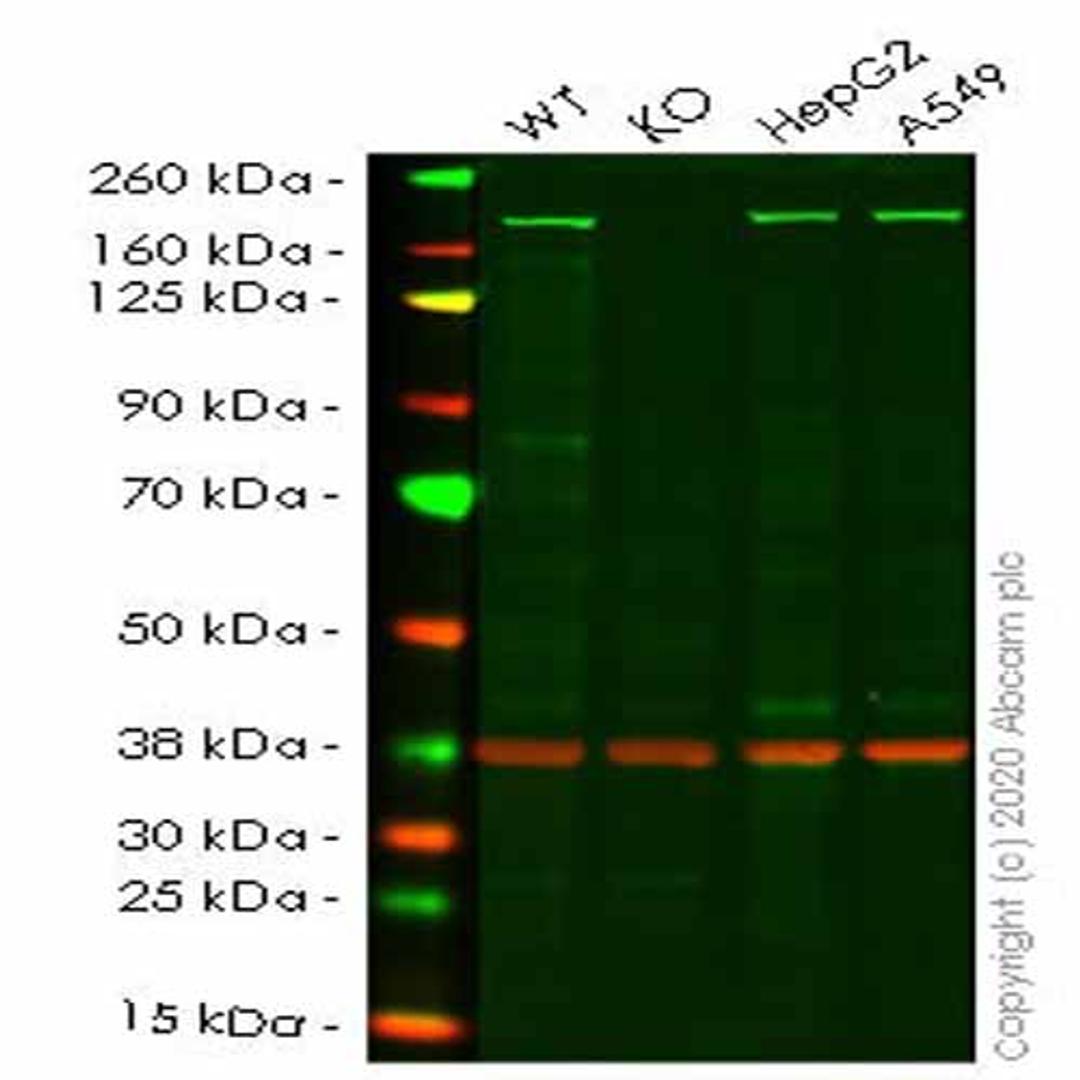 Human ROCK2 knockout HeLa cell line - Abcam plc - Life Sciences