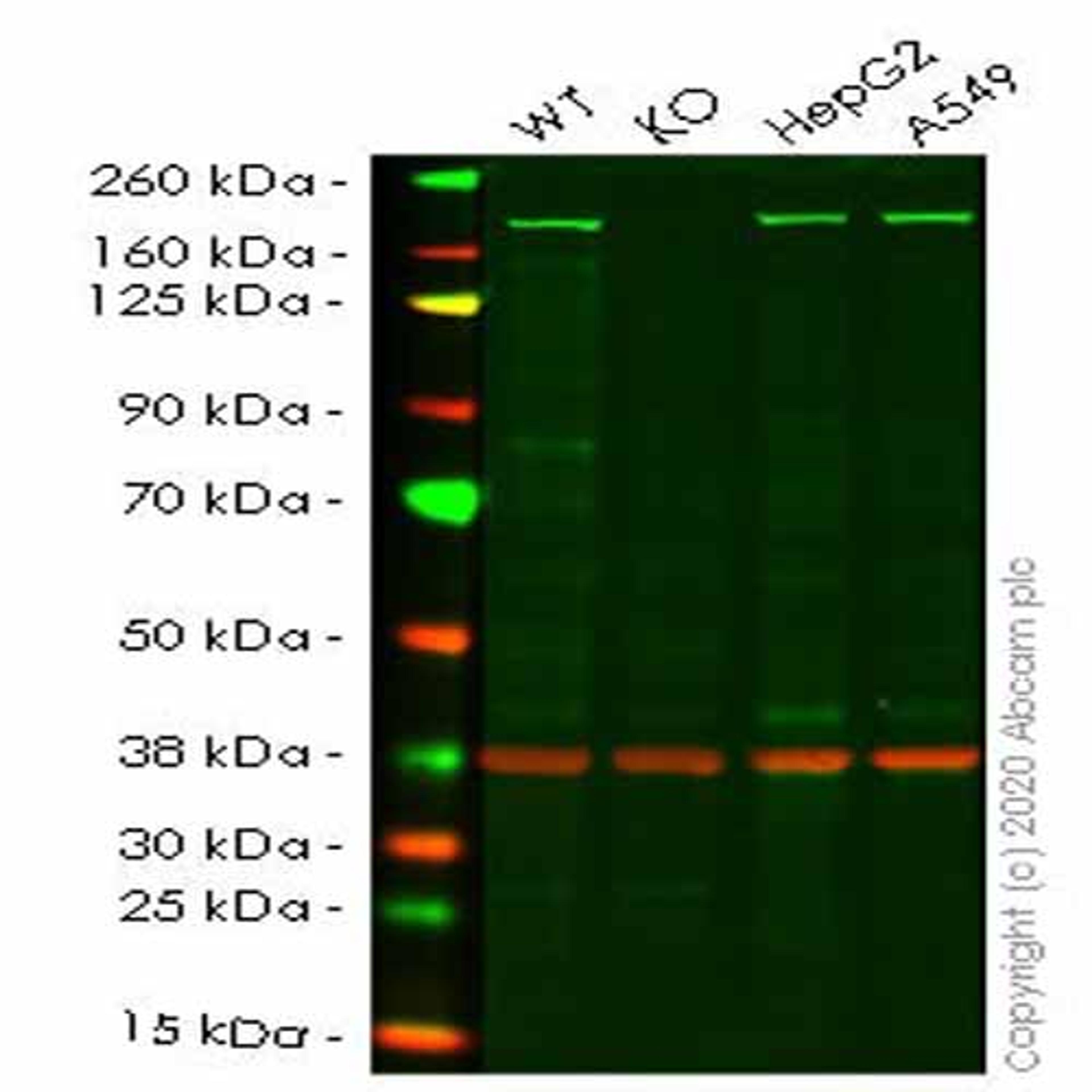 Human ROCK2 knockout HeLa cell line - Abcam plc - Life Sciences