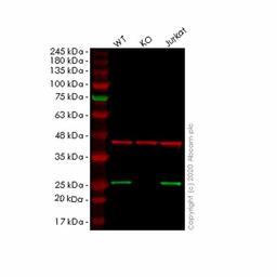 Human NDUFB9 knockout HeLa cell line - Abcam plc - Life Sciences