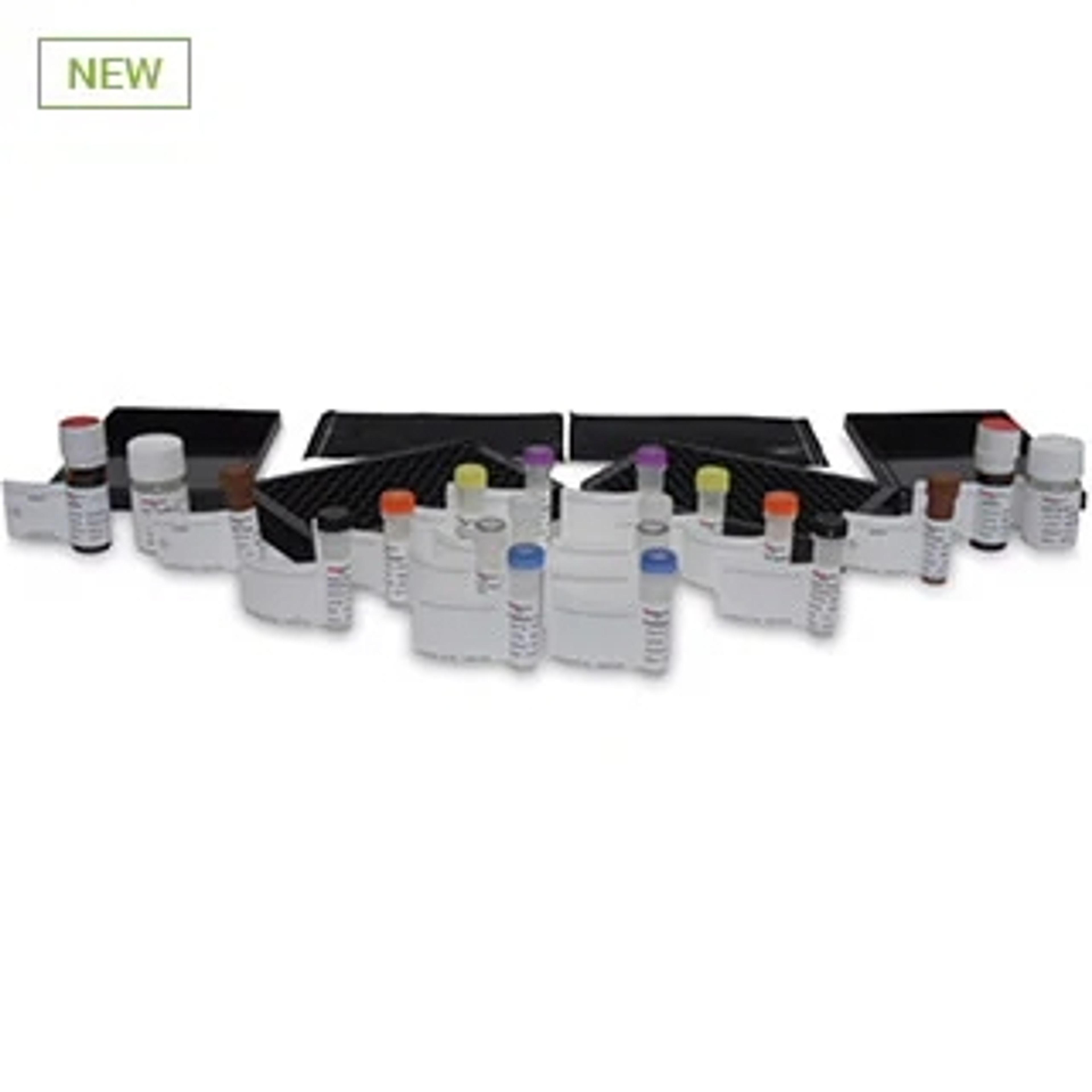 AdvanceBio Sialic Acid Quantitation - Agilent Technologies - Separations