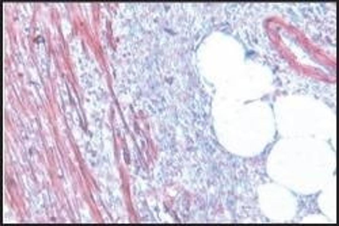Anti-Actin antibody produced in rabbit - Merck KGaA, Darmstadt, Germany - Life Sciences