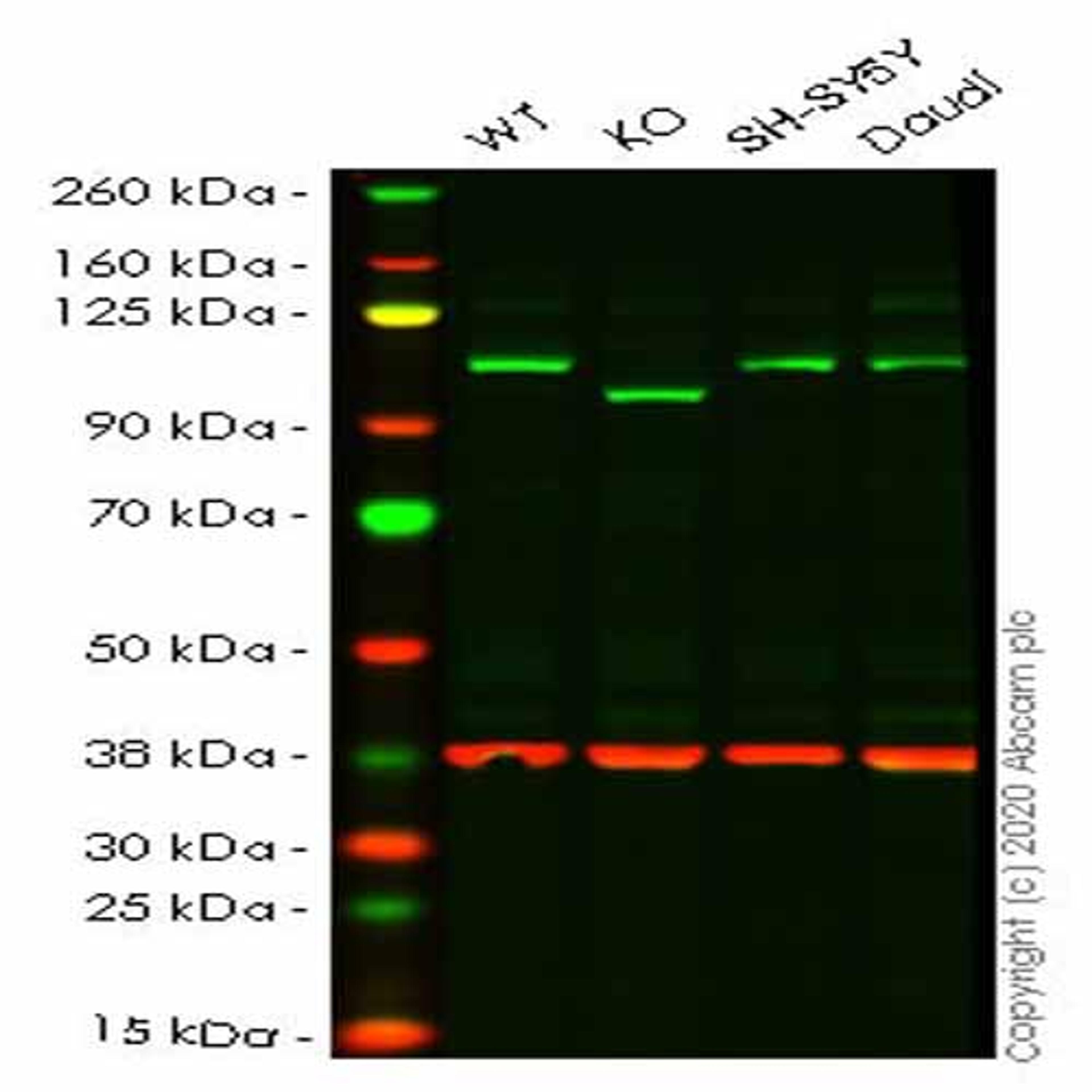Human EXOC2 knockout HeLa cell line - Abcam plc - Life Sciences