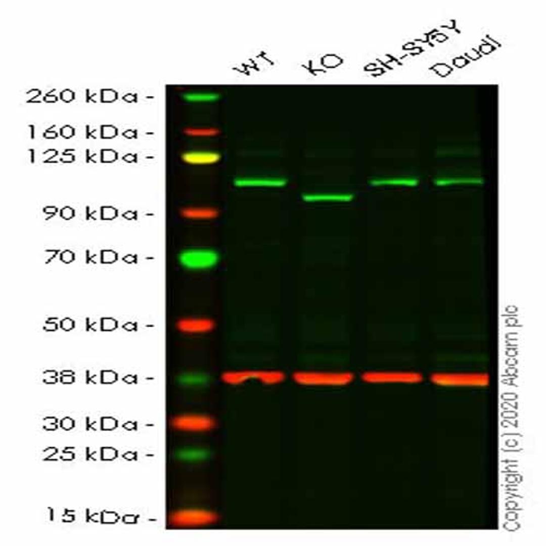 Human EXOC2 knockout HeLa cell line - Abcam plc - Life Sciences