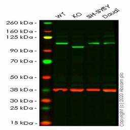Human EXOC2 knockout HeLa cell line - Abcam plc - Life Sciences