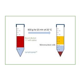 LymphoPrep™ (4x250mL) - PROGEN - General Lab