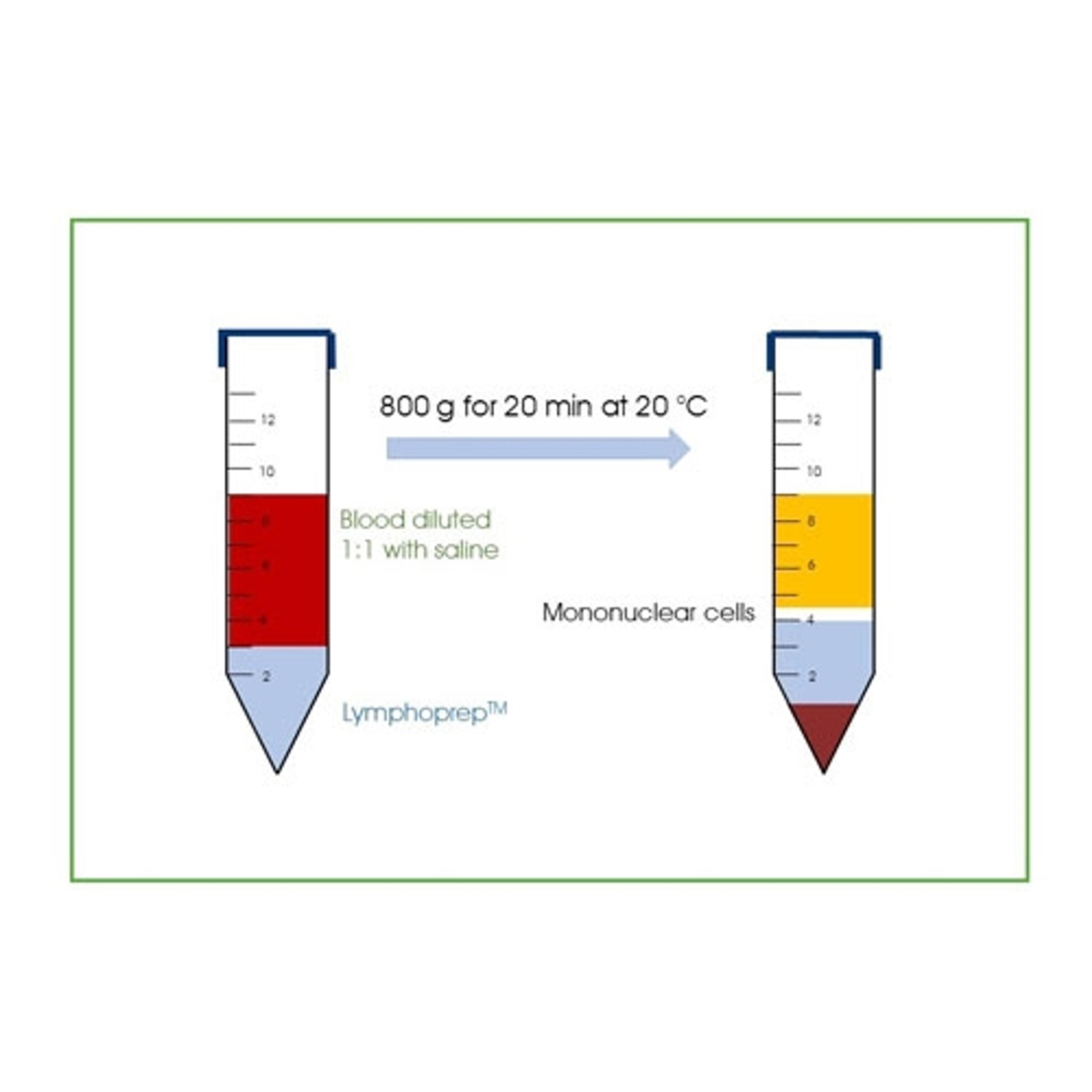 LymphoPrep™ (4x250mL) - PROGEN - General Lab