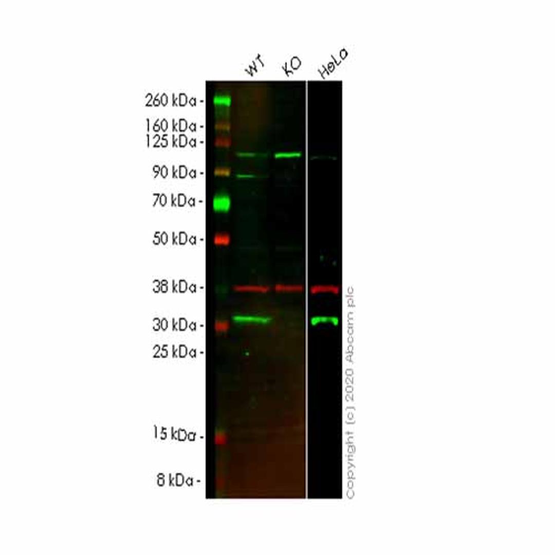 Human CBR1 knockout A549 cell line - Abcam plc - Life Sciences