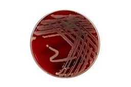 Thermo Scientific Blood Agar (TSA with Sheep Blood) Medium - Fisher Scientific - Life Sciences