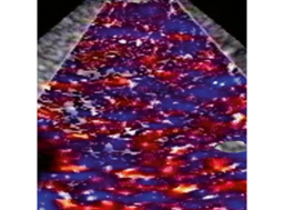 Ultrasound Contras Agents - PolySon™ - Scintica - Life Sciences