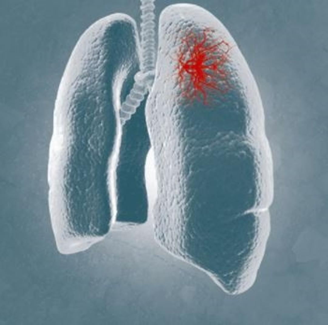 FTD Respiratory pathogens 21 - Fast Track Diagnostics - Life Sciences