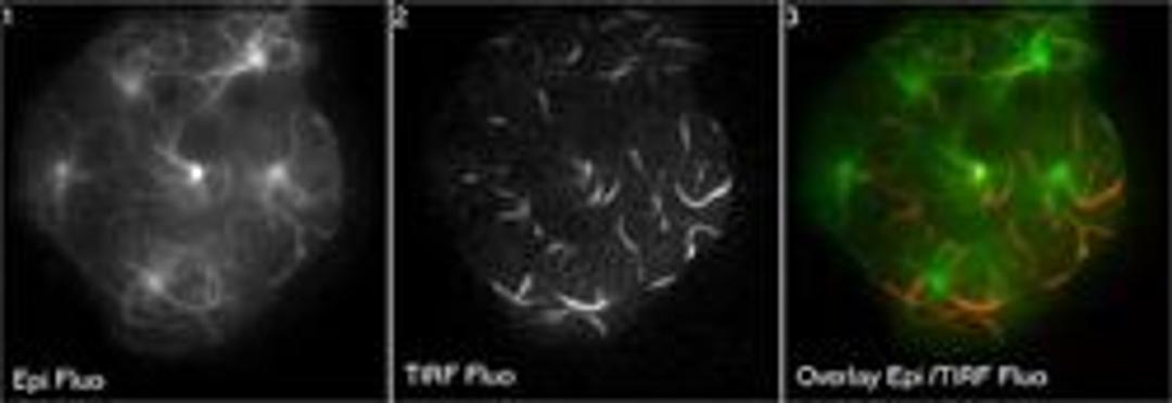 Visitron TIRF system - Photon Lines Ltd - Life Sciences