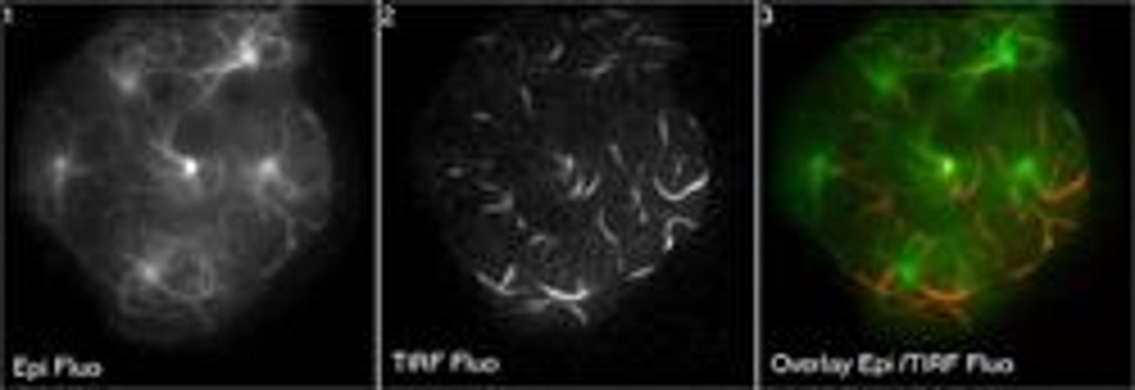 Visitron TIRF system - Photon Lines Ltd - Life Sciences