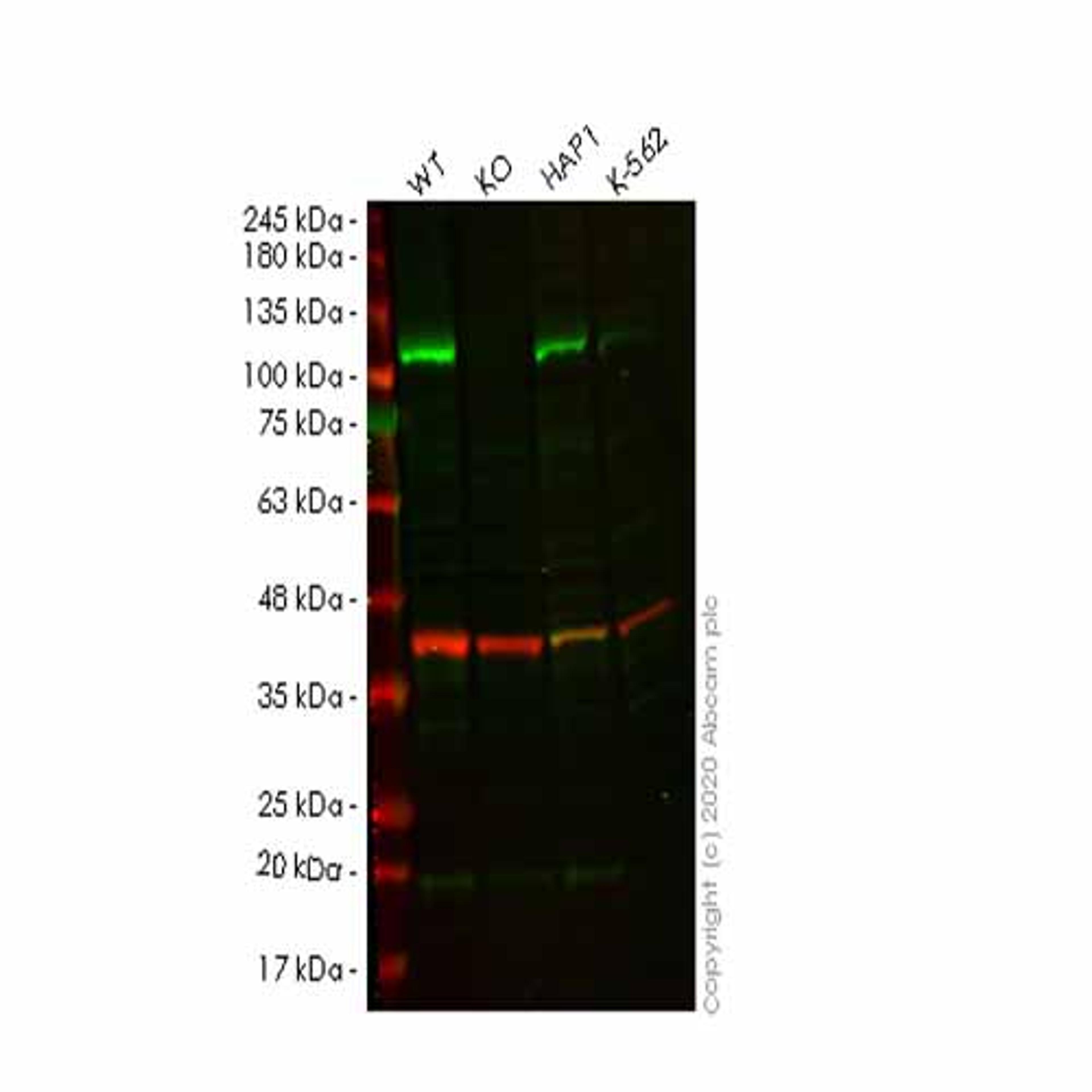 Human ITCH (AIP4) knockout HeLa cell line - Abcam plc - Life Sciences