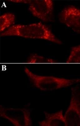 Anti-LC3B antibody produced in rabbit - Merck KGaA, Darmstadt, Germany - Life Sciences