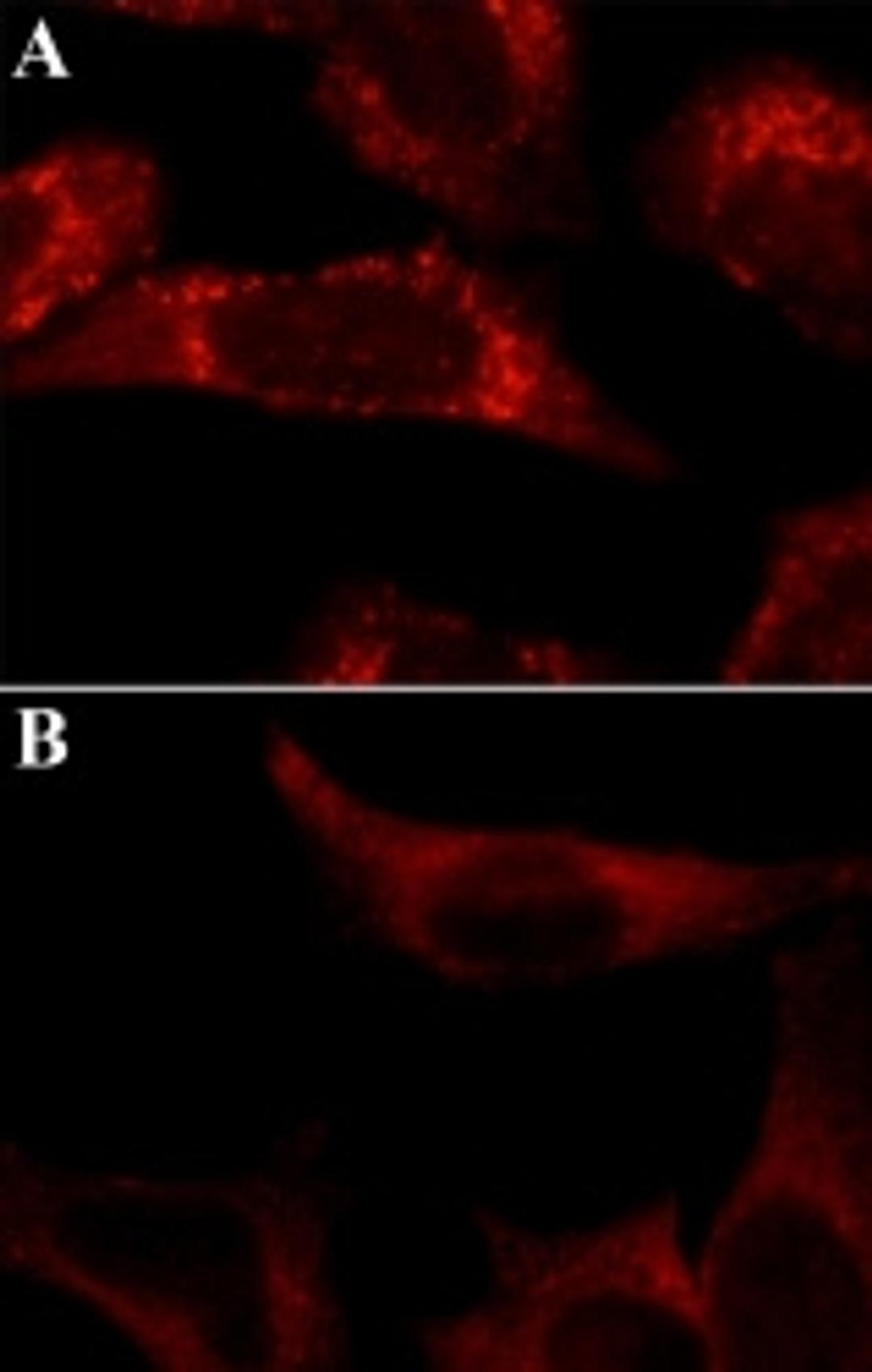 Anti-LC3B antibody produced in rabbit - Merck KGaA, Darmstadt, Germany - Life Sciences