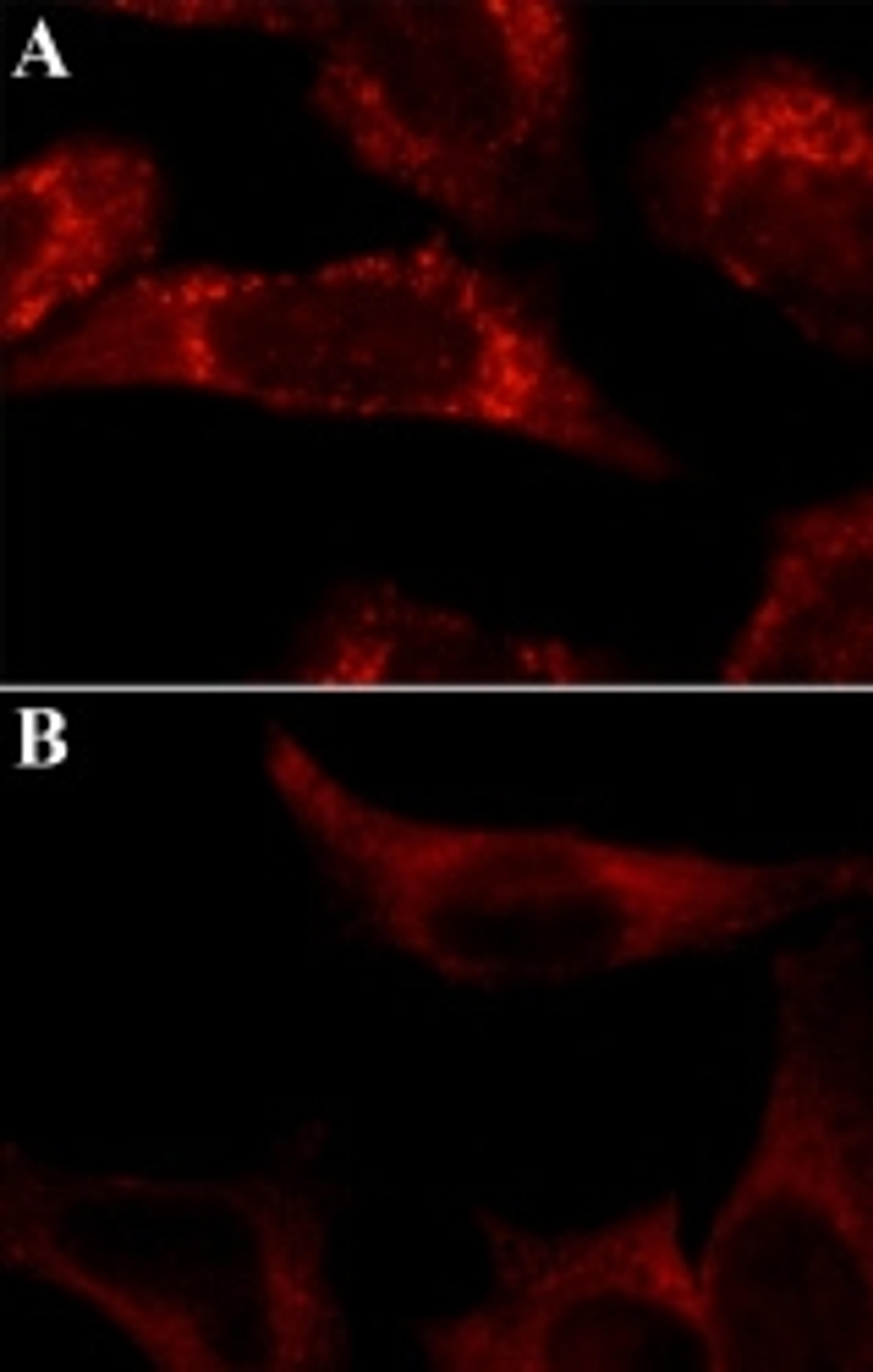 Anti-LC3B antibody produced in rabbit - Merck KGaA, Darmstadt, Germany - Life Sciences