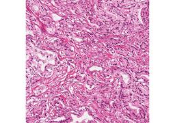 Normal and Disease State Tissue - BioIVT - Life Sciences