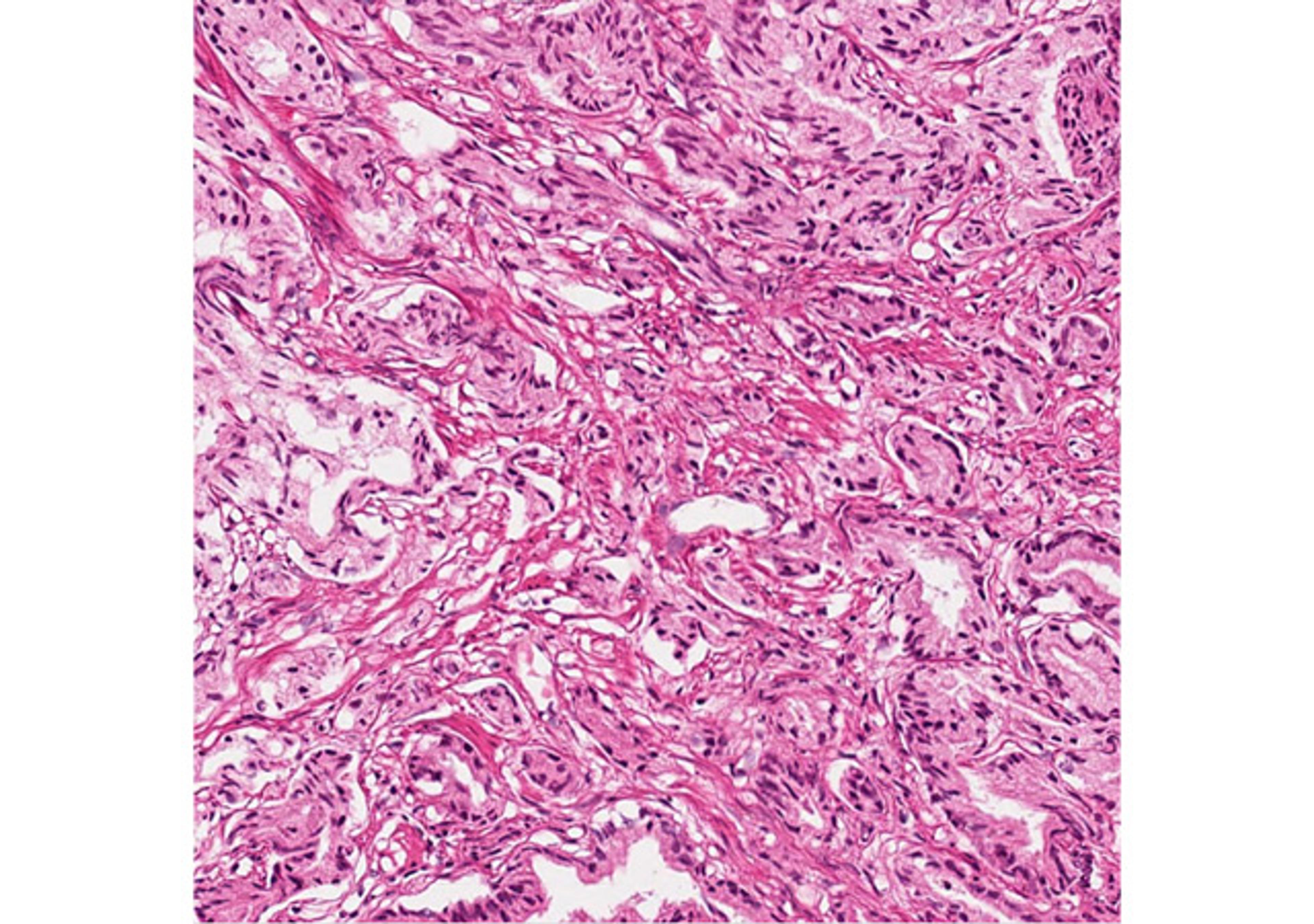 Normal and Disease State Tissue - BioIVT - Life Sciences