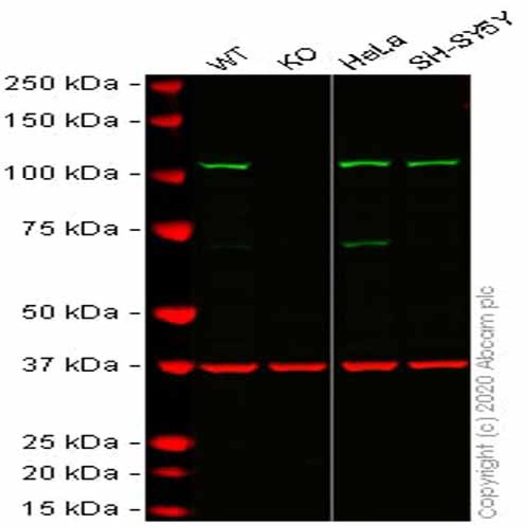 Human HK2 (Hexokinase II) knockout HCT116 cell line - Abcam plc - Life Sciences
