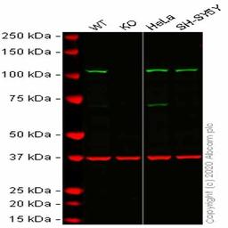 Human HK2 (Hexokinase II) knockout HCT116 cell line - Abcam plc - Life Sciences