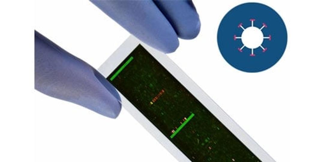 PEPperCHIP® Flavivirus Proteome Microarrays - PEPperPRINT GmbH - Life Sciences