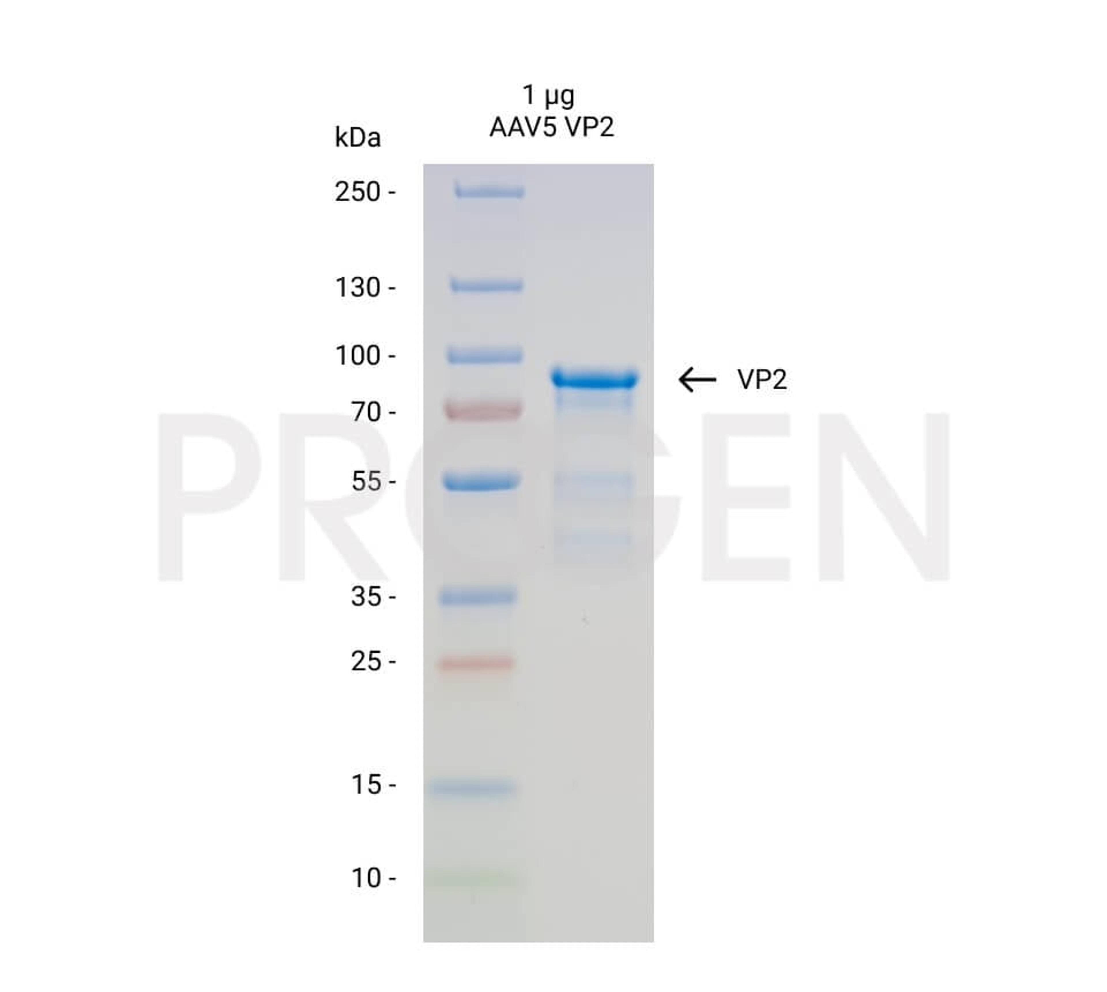 AAV5 VP2, recombinant protein - PROGEN