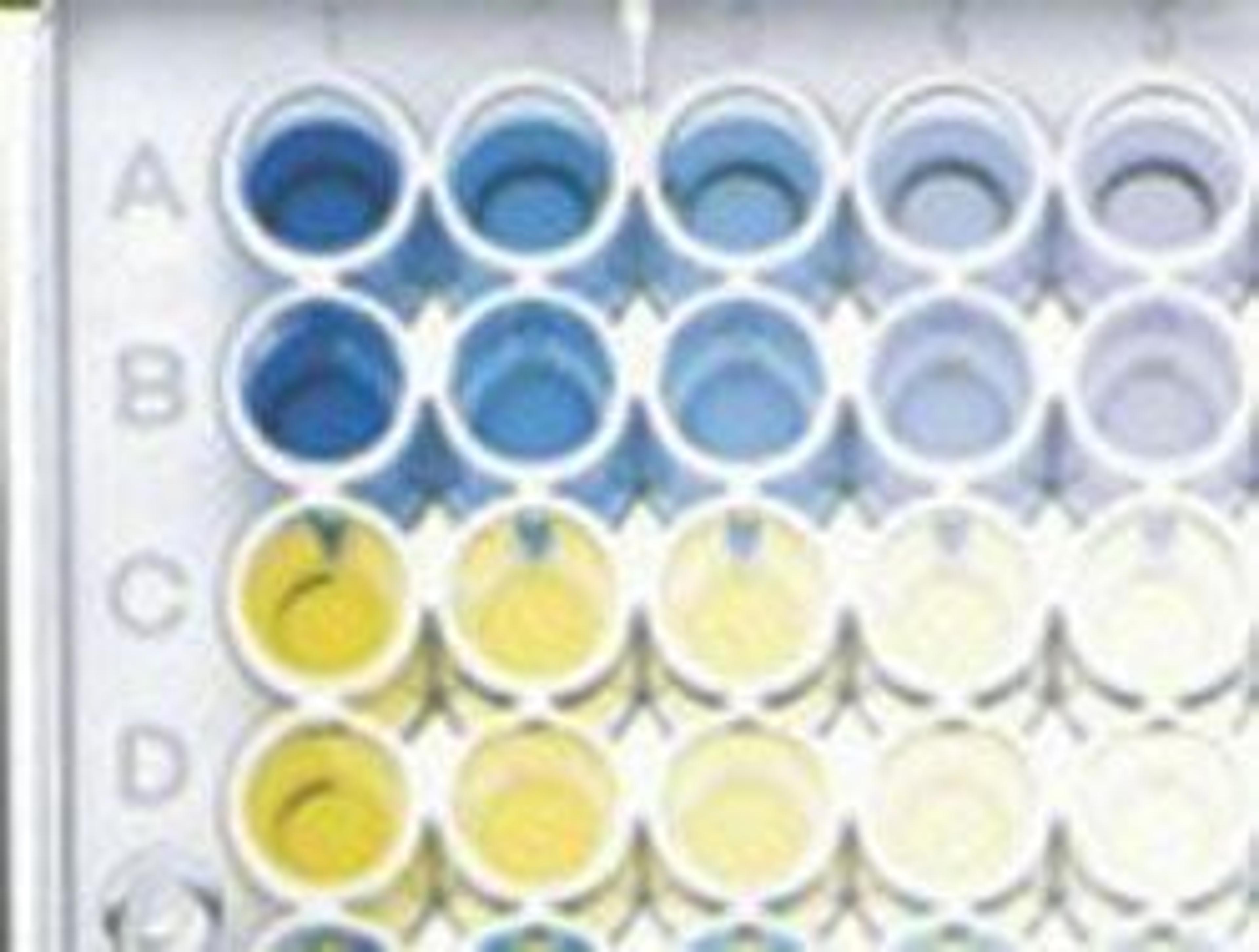 TMB SENS - Standard - null - Life Sciences