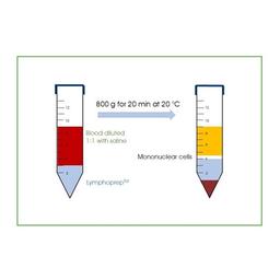 LymphoPrep™ (6x500mL) - PROGEN - General Lab