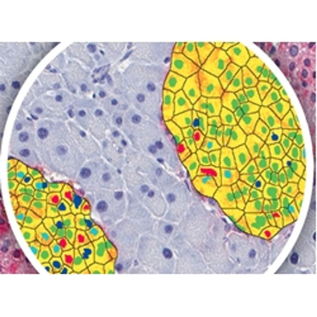 Biomarker image analysis with Pharma Services