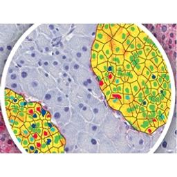 Biomarker image analysis with Pharma Services