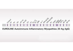 EUROLINE Myositis Profiles - Euroimmun - Clinical Diagnostics