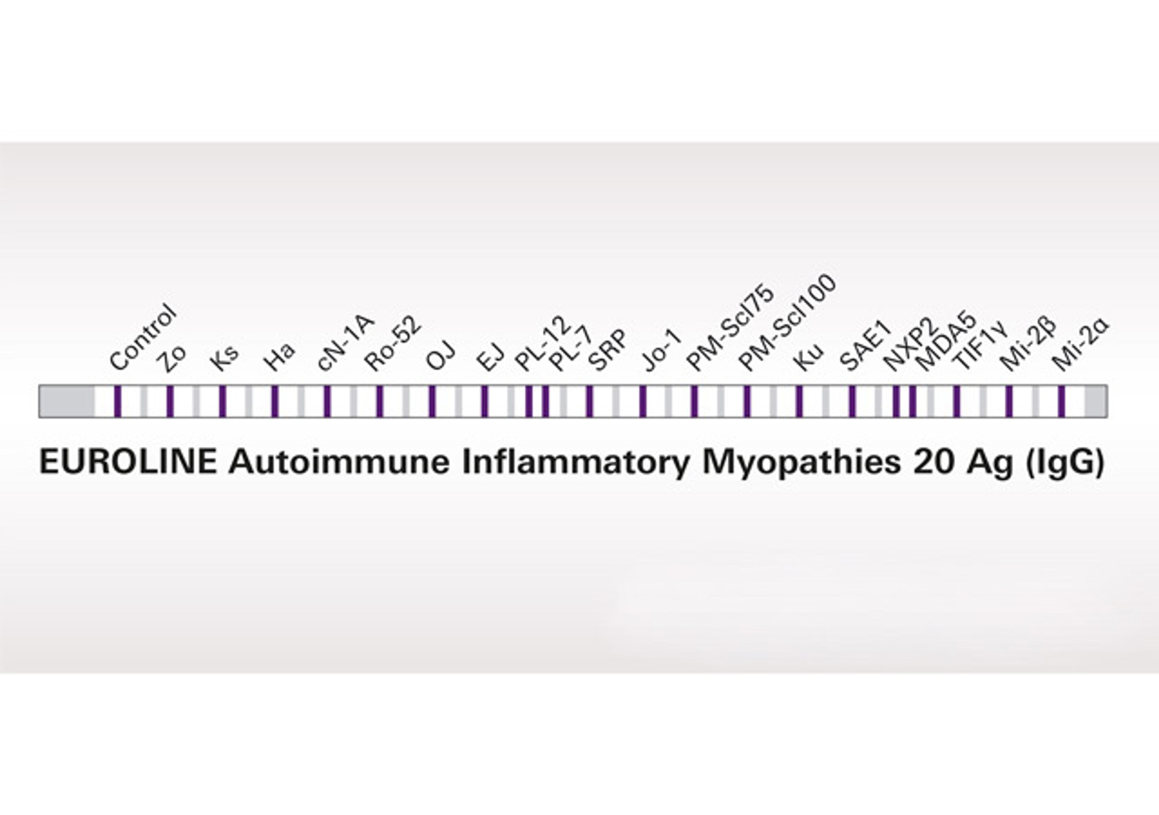 EUROLINE Myositis Profiles - Euroimmun - Clinical Diagnostics