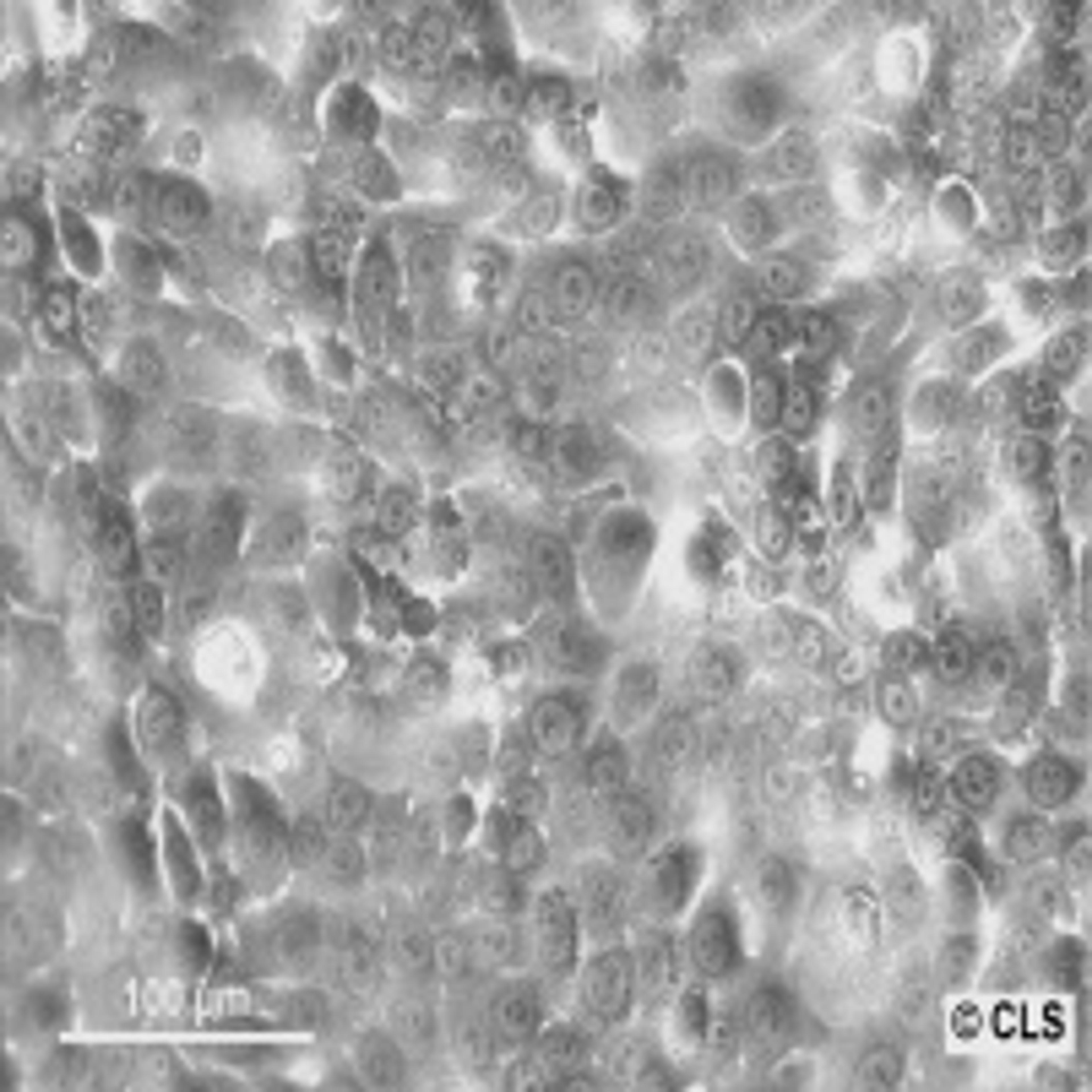 Capan-1 - Cell Lines Service GmbH - Life Sciences
