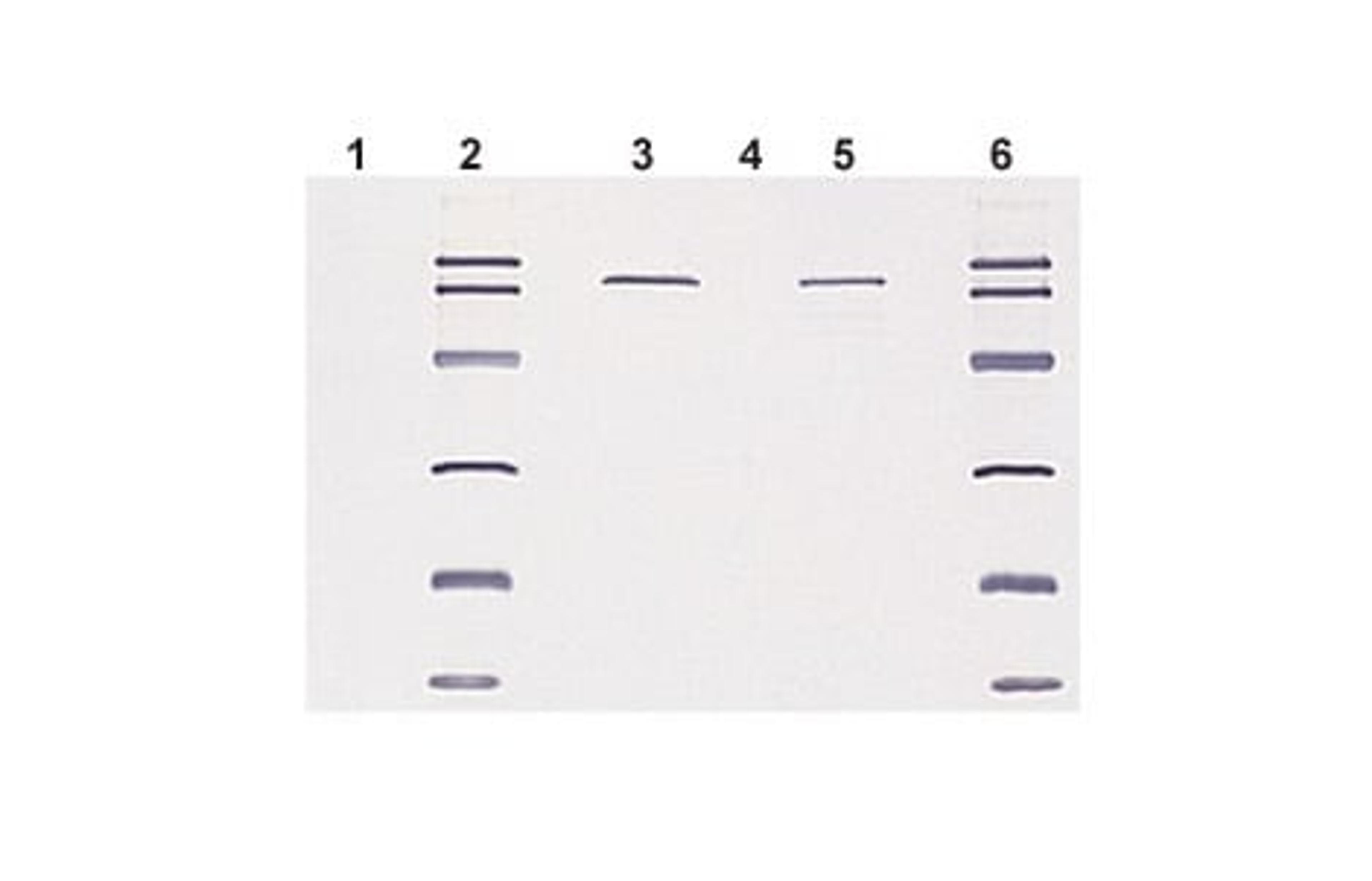 HRP and AP Conjugates