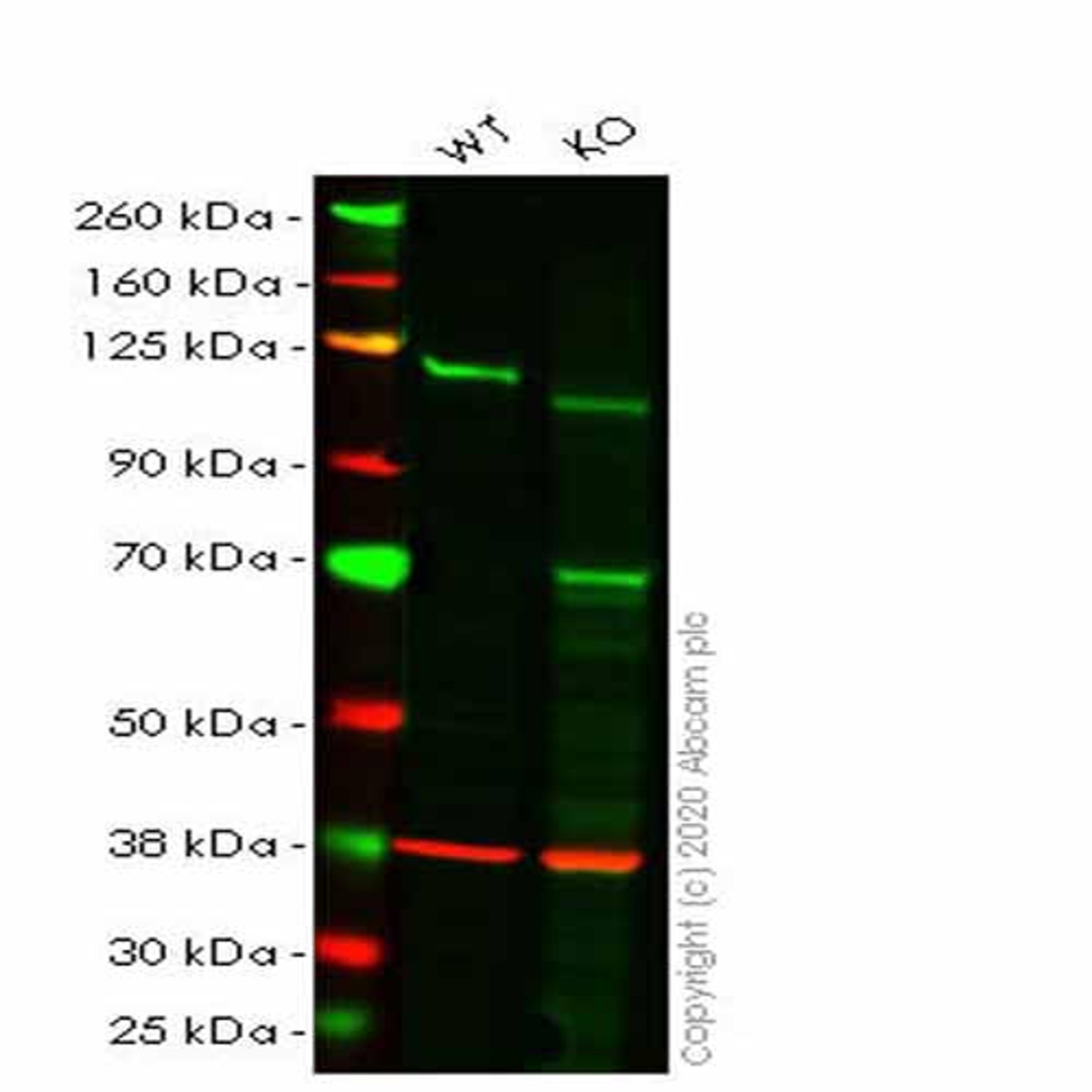 Human NFKB2 (NFkB p100/NFKB2) knockout HepG2 cell line - Abcam plc - Life Sciences