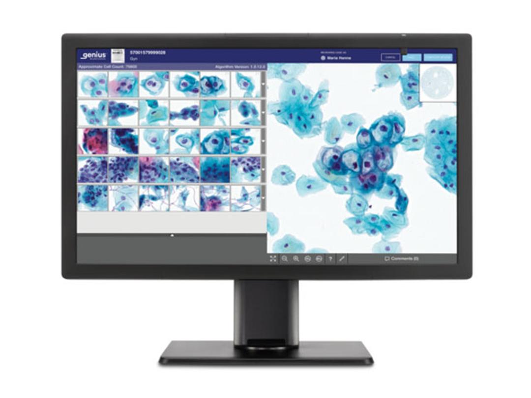 Genius™ Digital Diagnostics System - Hologic, Inc. - Clinical Diagnostics