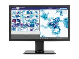 Genius™ Digital Diagnostics System - Hologic, Inc. - Clinical Diagnostics