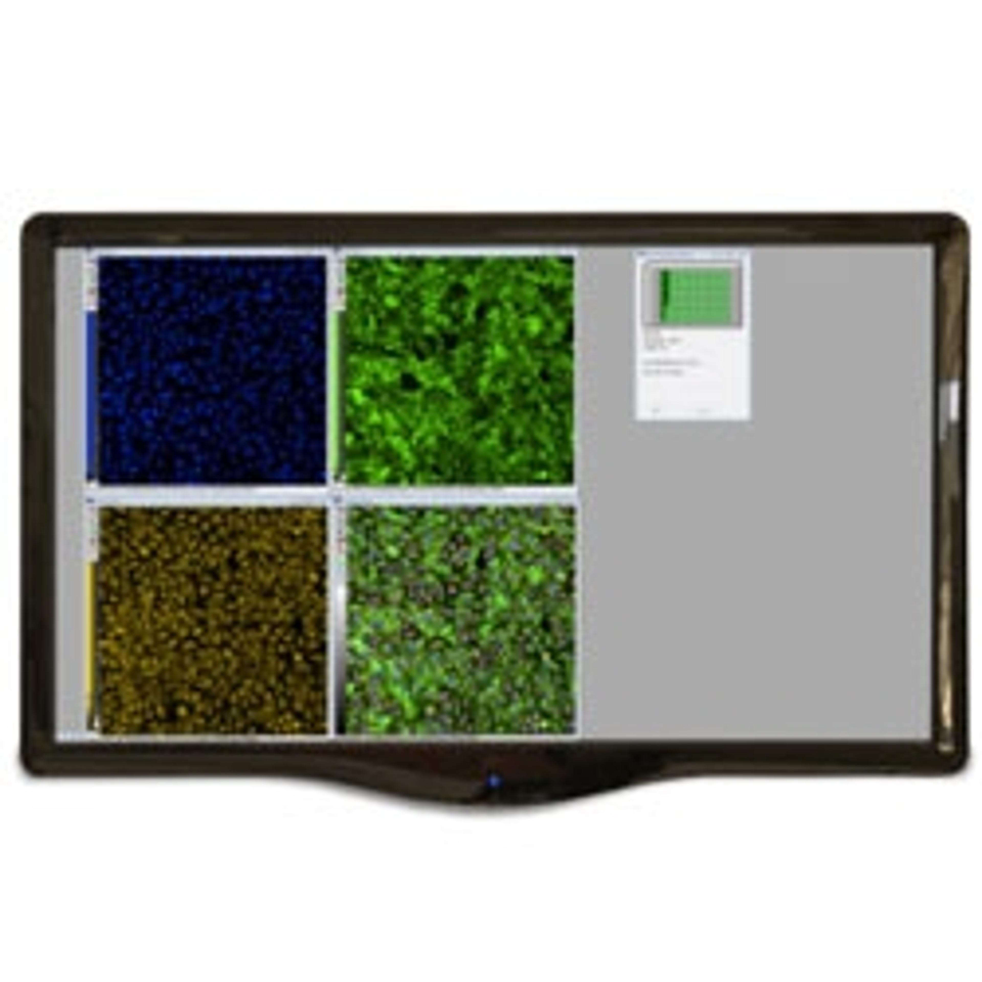 MetaXpress High-Content Image Acquisition and Analysis Software - Molecular Devices® - Drug discovery > Target Discovery